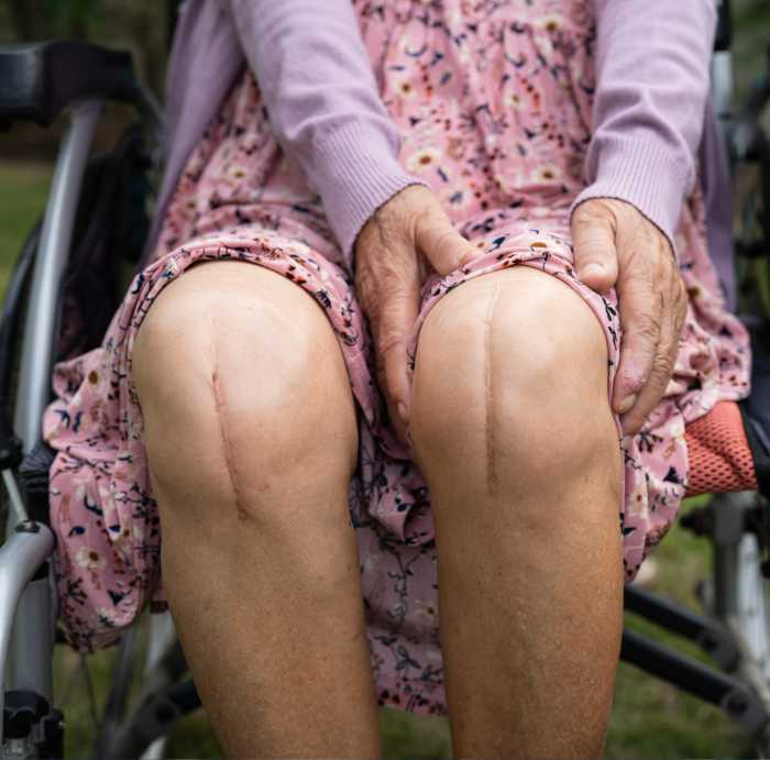 Knee, legs and joint pain of gym man, athlete and training, workout or exercise in fitness club. Bo.