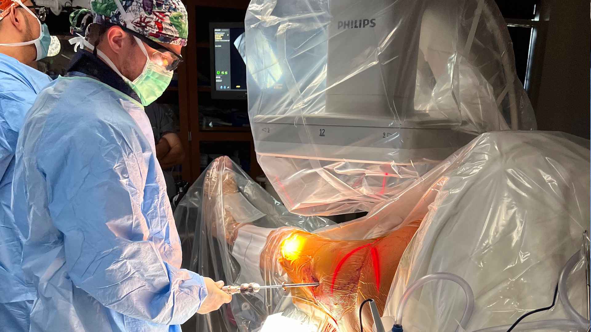 Hip Arthroscopy process