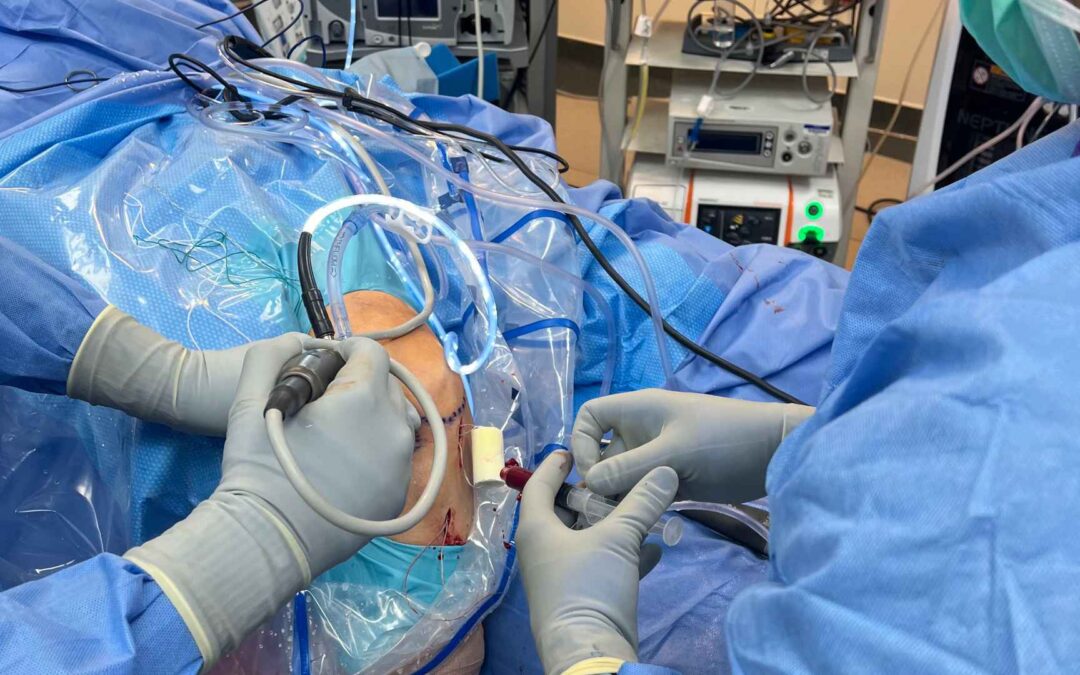 Anterior cruciate ligament (ACL) injuries are one of the most common and disruptive knee injuries.