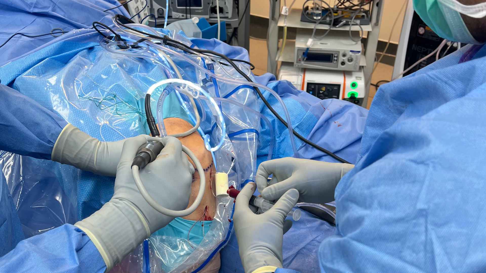 Hip Arthroscopy process