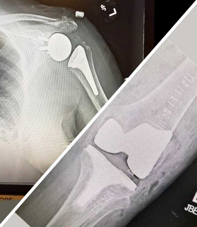 home page knee and shoulder 2