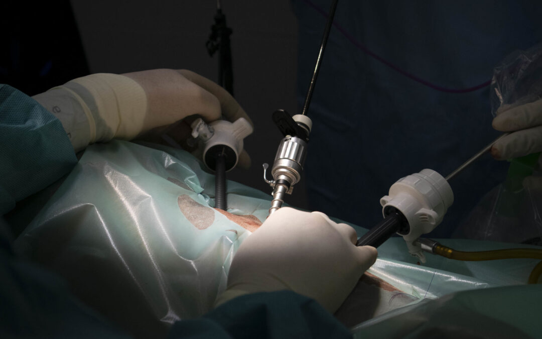 Arthroscopic Surgery for Shoulder & Knee Injuries: Benefits & Recovery